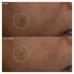 Clinique