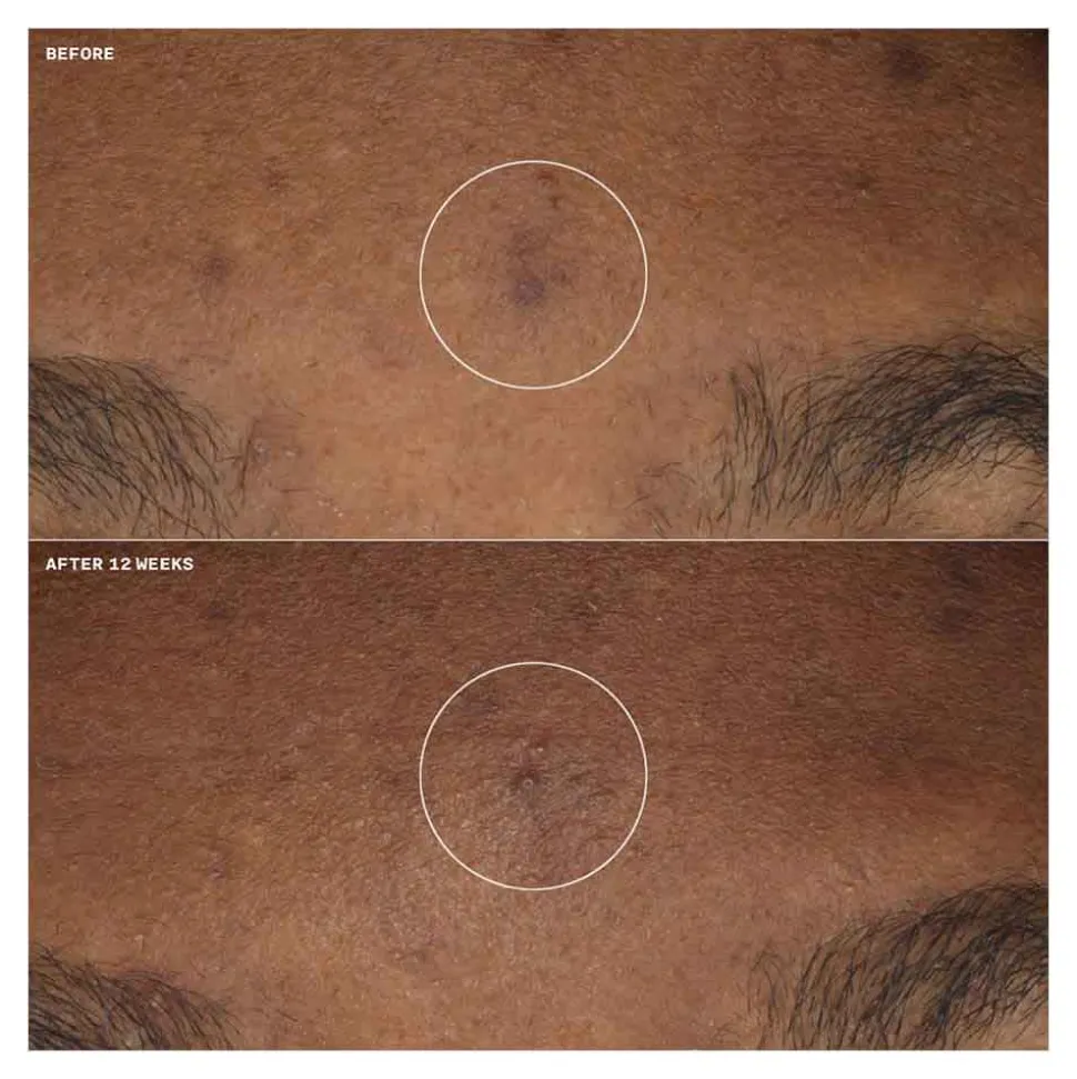 Clinique