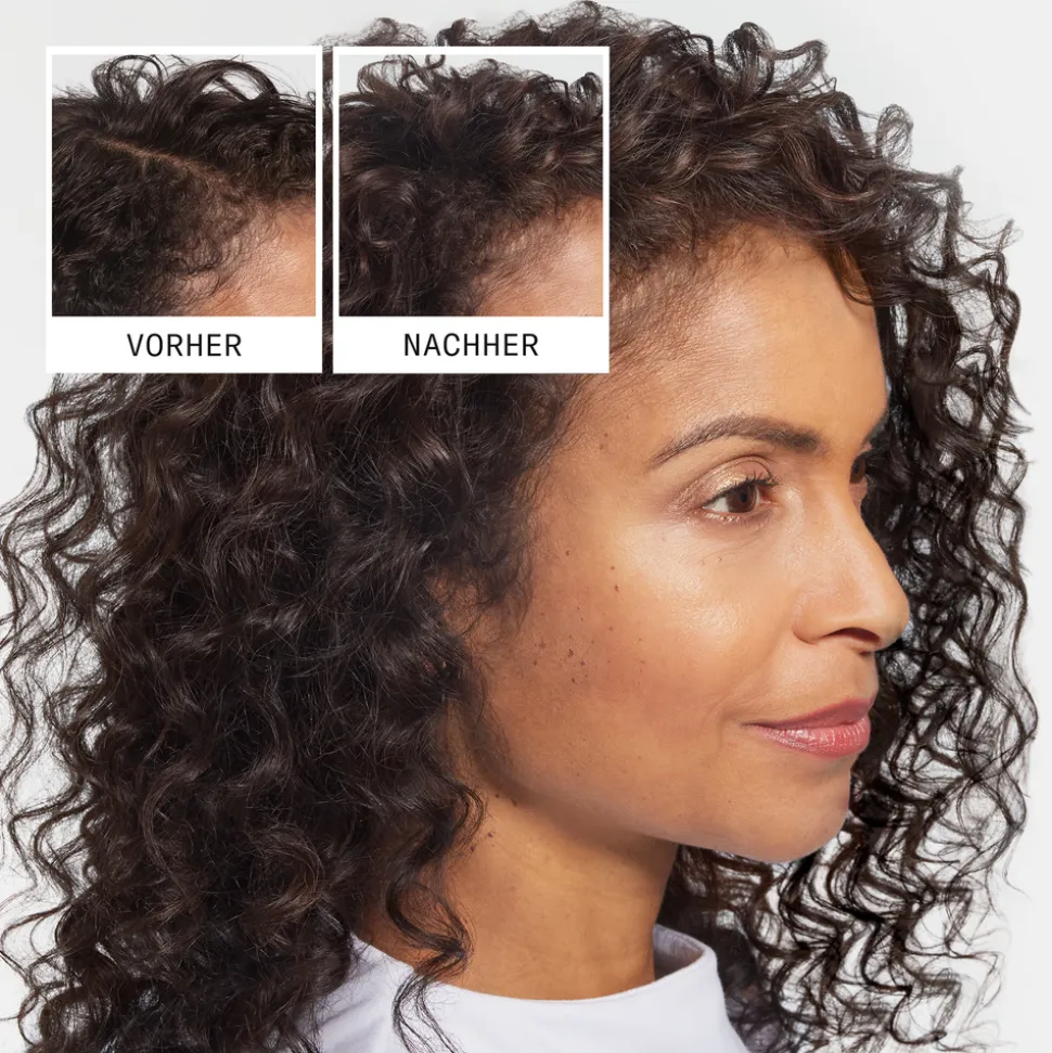 NIOXIN